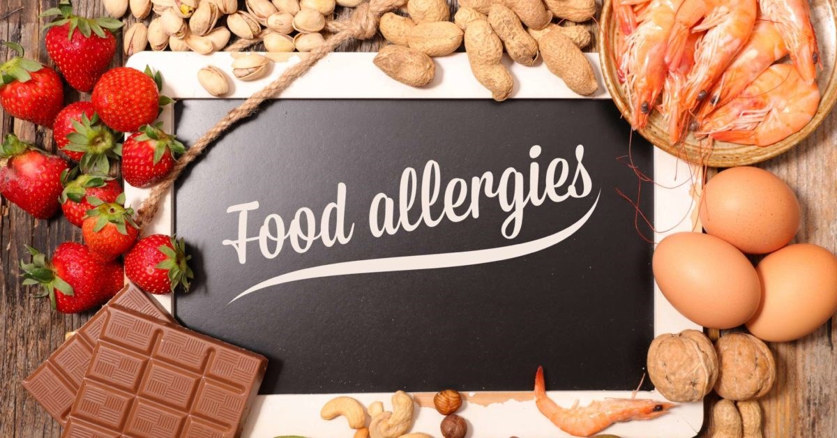Food Allergies Types
